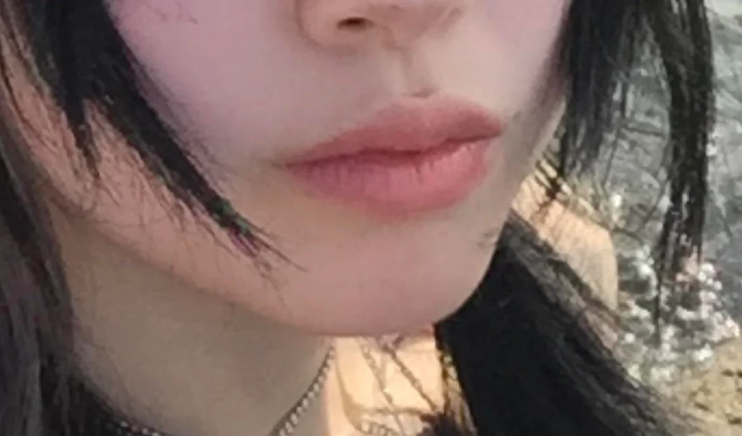 help-be-so-honest-with-me-do-i-have-lip-filler-blindness-v0-jhzrhwh80vgh1 - help-be-so-honest-with-me-do-i-have-lip-filler-blindness-v0-jhzrhwh80vgh1