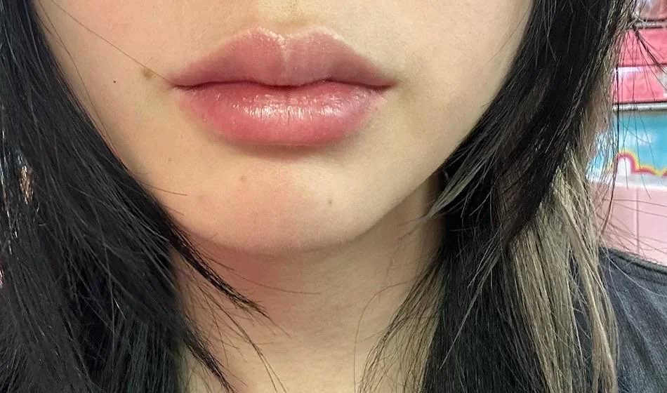help-be-so-honest-with-me-do-i-have-lip-filler-blindness-v0-pf0zlvh80vgh1 - help-be-so-honest-with-me-do-i-have-lip-filler-blindness-v0-pf0zlvh80vgh1